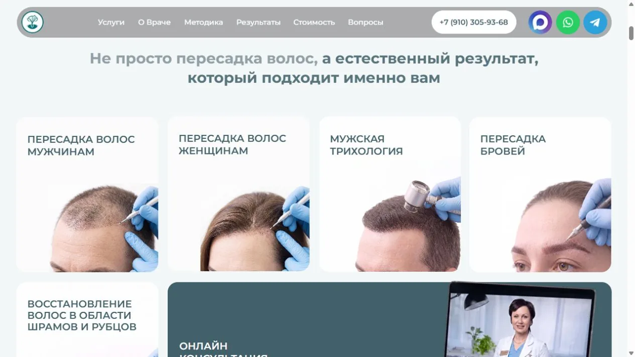 Hair transplant service segmentation on Ekaterina Shamatrina's website